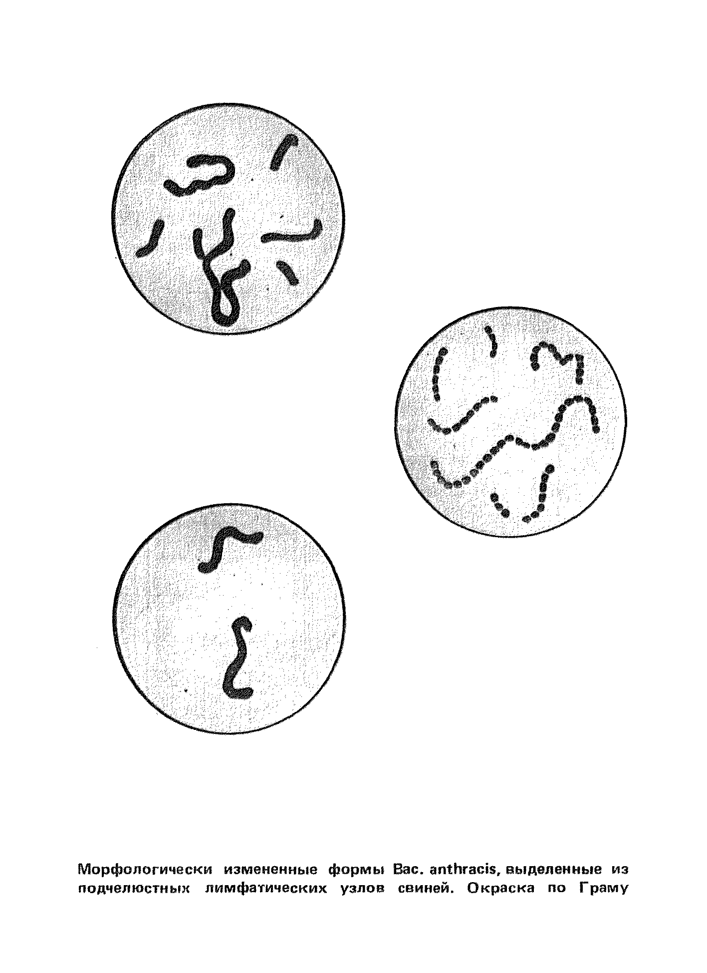 биологический метод исследования сибирской язвы. сибирская язва микроскопия тест жемчужное ожерелье. тест жемчужное ожерелье. методы лабораторной диагностики сибирской язвы. жемчужное ожерелье микробиология.